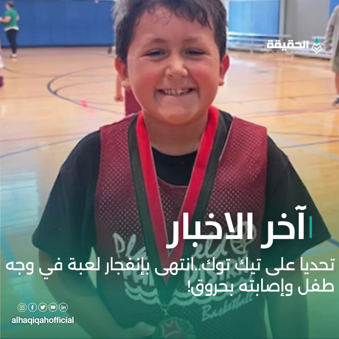 تحديا على تيك توك..انتهى بإنفجار لعبة في وجه طفل وإصابته بحروق!