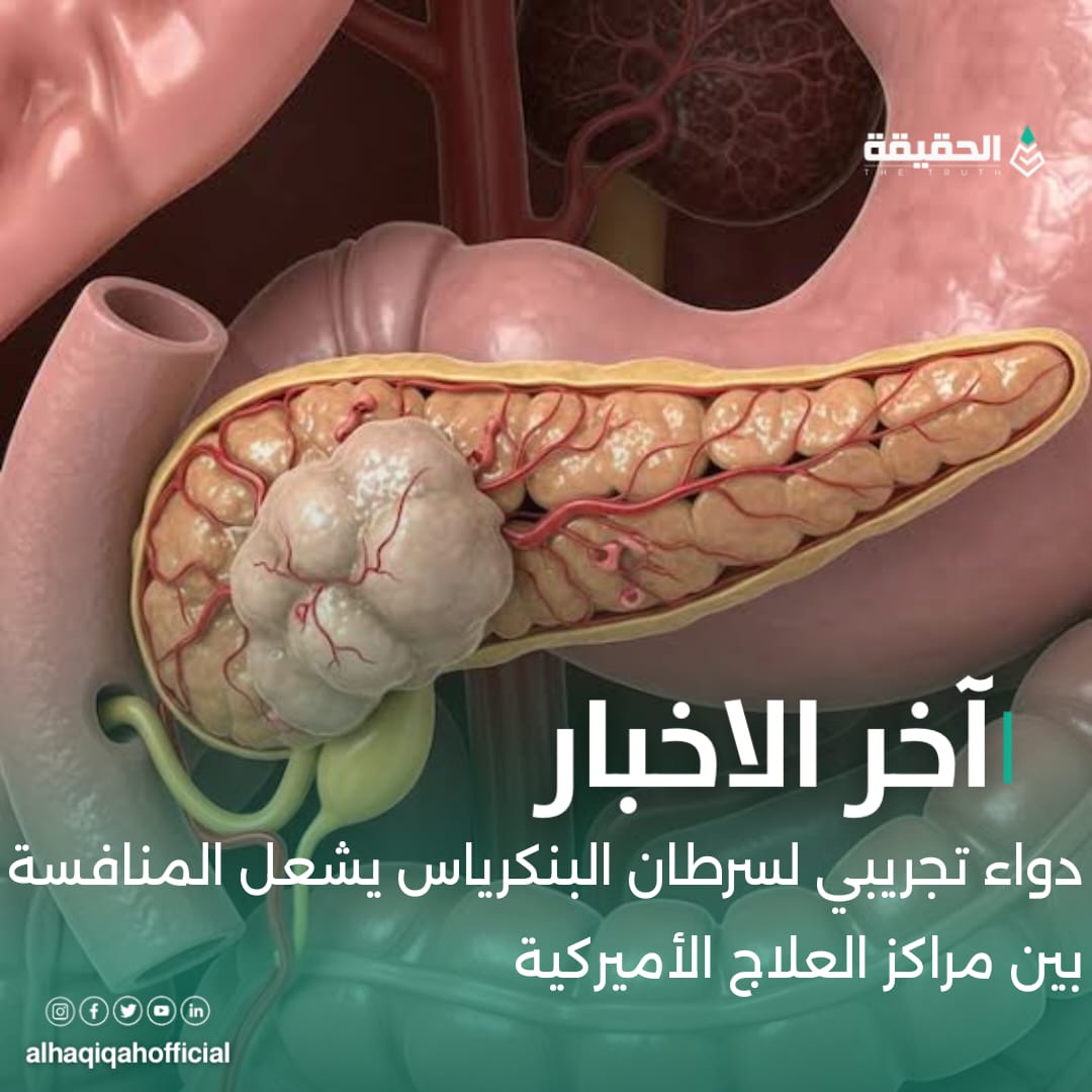 دواء تجريبي لسرطان البنكرياس يشعل المنافسة بين مراكز العلاج الأميركية
